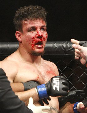 mir-bloody-ufc-100.jpg